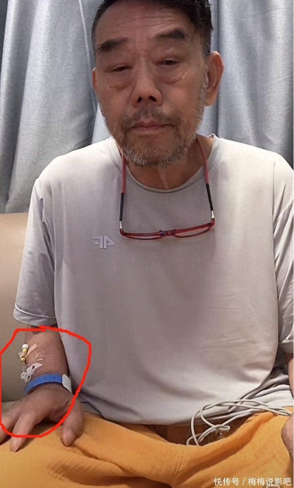 东莞股票配资 杨伦带留置针开播，胡子拉碴气色差，杨议一句话拆台：你别装了！
